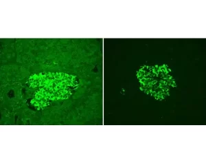 Adjacent sections of Human Pancreas FFPE tissue stained for insulin using fluorescein label (green) and mounted with VECTASHIELD Vibrance Antifade Mounting Medium. Note significant reduction of autofluorescence in treated section (right).