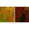 Adjacent sections of Human Pancreas FFPE tissue stained for insulin using fluorescein label (green) and mounted with VECTASHIELD Vibrance Antifade Mounting Medium. Note significant reduction of autofluorescence in treated section (right).