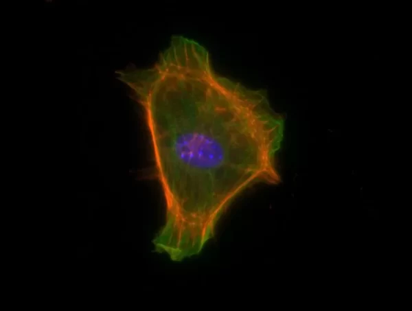 Mouse embryonal fibroblasts: Anti-Tubulin (m) detected with DyLight 488 Anti-Mouse IgG and Vinculin (rp) detected with DyLight 649 Anti-Rabbit IgG. Mounted in a 1:1 mixture of VECTASHIELD HardSet Mounting Medium with DAPI and VECTASHIELD HardSet Mountin