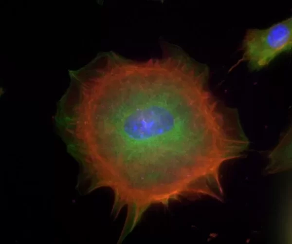 Mouse embryonal fibroblasts: Anti-Cytokeratin (m) detected with DyLight 488 Anti-Mouse IgG, mounted in a 1:1 mixture of VECTASHIELD HardSet Mounting Medium with DAPI and VECTASHIELD HardSet Mounting Medium with TRITC-Phalloidin.