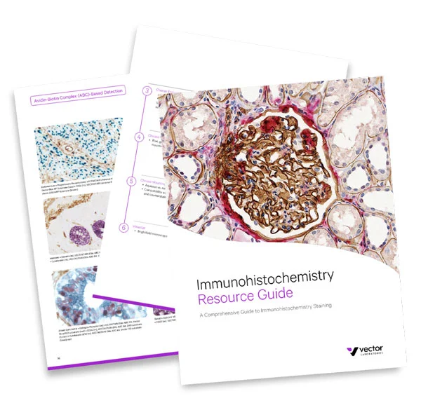 IHC Guide pages 9 22 1024x981 1